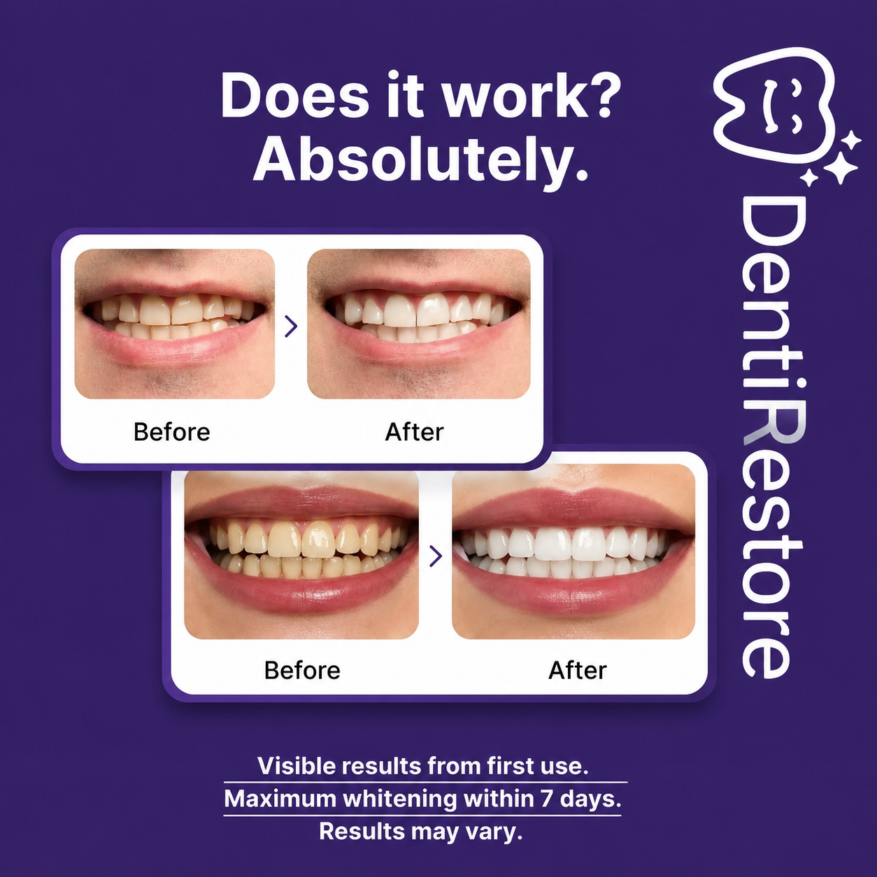 Whiten Your Teeth Up To 8 Shades In 14 Days DentiRestore Teeth Whitening Strips