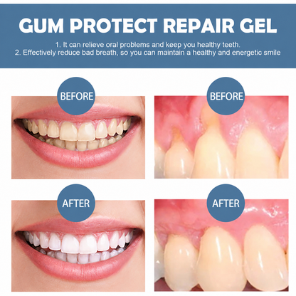 Dentirestore™  Gumline Care Gel — Targeted Overnight Care for Red, Sensitive & Uncomfortable Gums