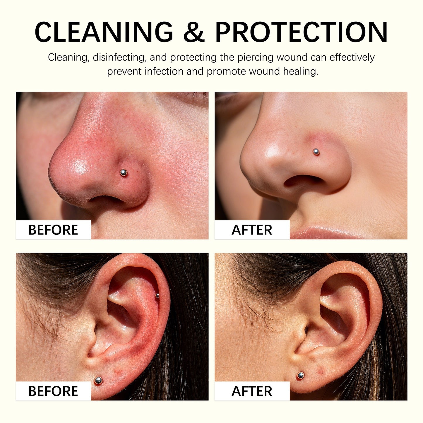 Piercing Bump Solution - Soothing Essential Oil for Piercing Bumps Keloids & Scars - 15ml Gentle Blend with Rosemary Tea Tree for Nose Ears Body Piercings
